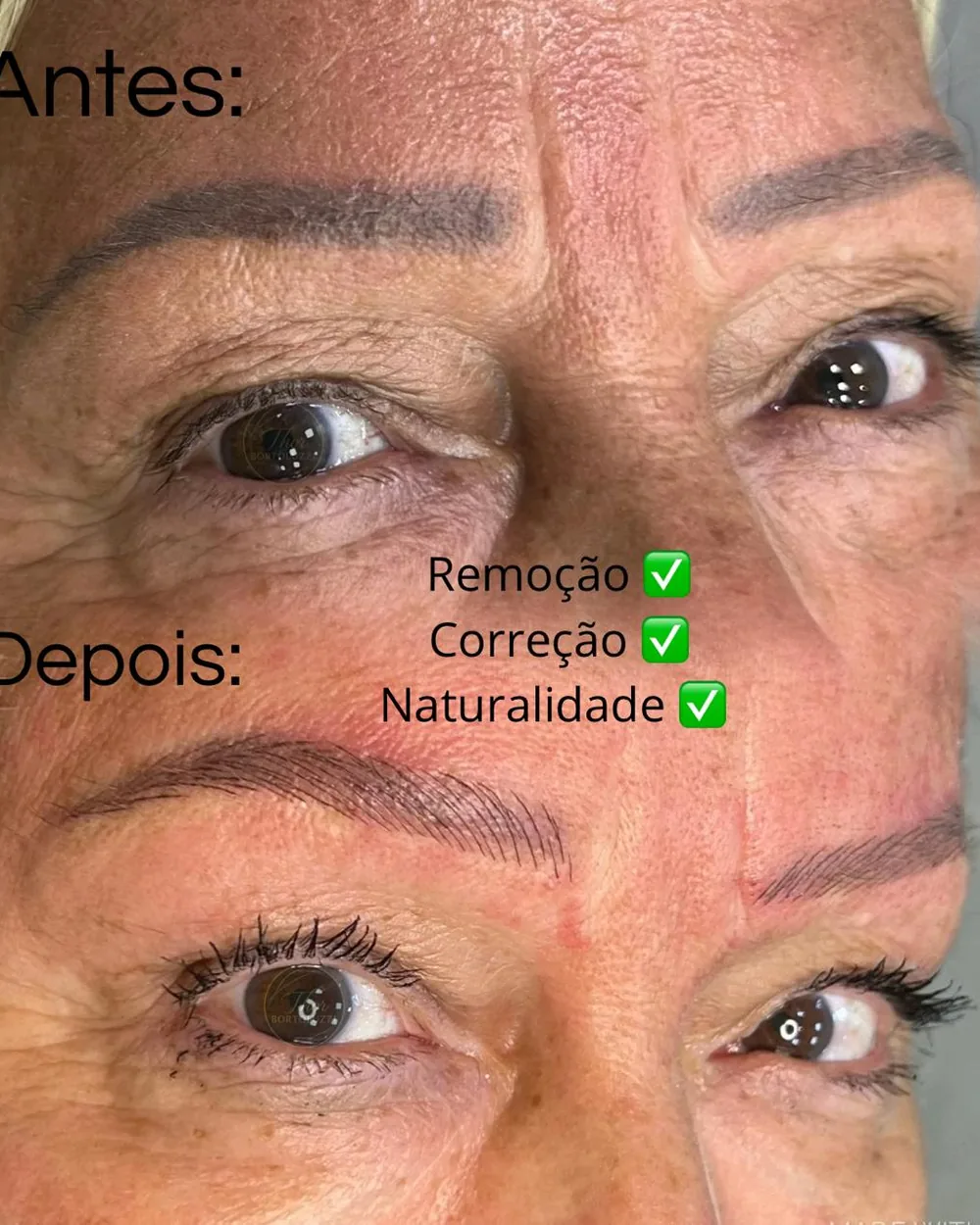 Antes e depois de sobrancelha com remoção, correção e micropigmentação fio a fio, resultado natural, em Caraguatatuba